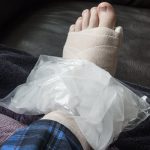 InjuredAnkle2