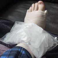InjuredAnkle2 InjuredAnkle2